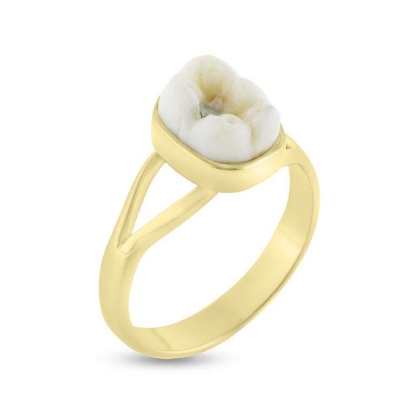 Billede af Tandring 1 kindtand (incl. ny ring) 14 kt